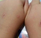 Así es 'El abecedario del diablo': el juego sádico que impone a los niños una herida por cada letra